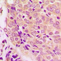 GSK3A / GSK3 Alpha Antibody (N-Terminus)