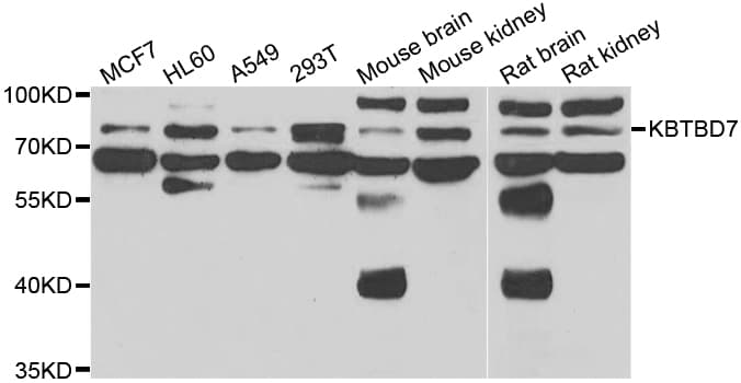 KBTBD7 Antibody