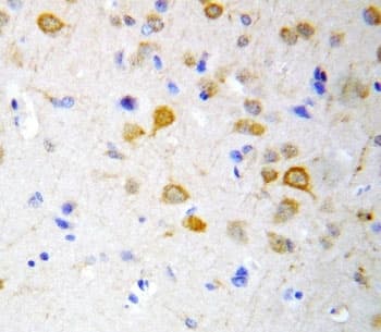 HTR2A / 5-HT2A Receptor Antibody (aa418-432)