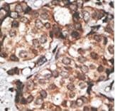 HTRA3 Antibody (aa112-144)
