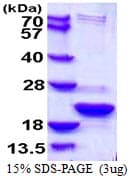 Human TXNL4B Protein (Recombinant His)