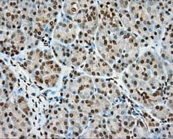 HMRF1L / MTRF1L Antibody (clone OTI2B5)