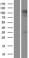 TBC1D2B Protein (Over-Expression Lysate Myc-DDK (Flag))
