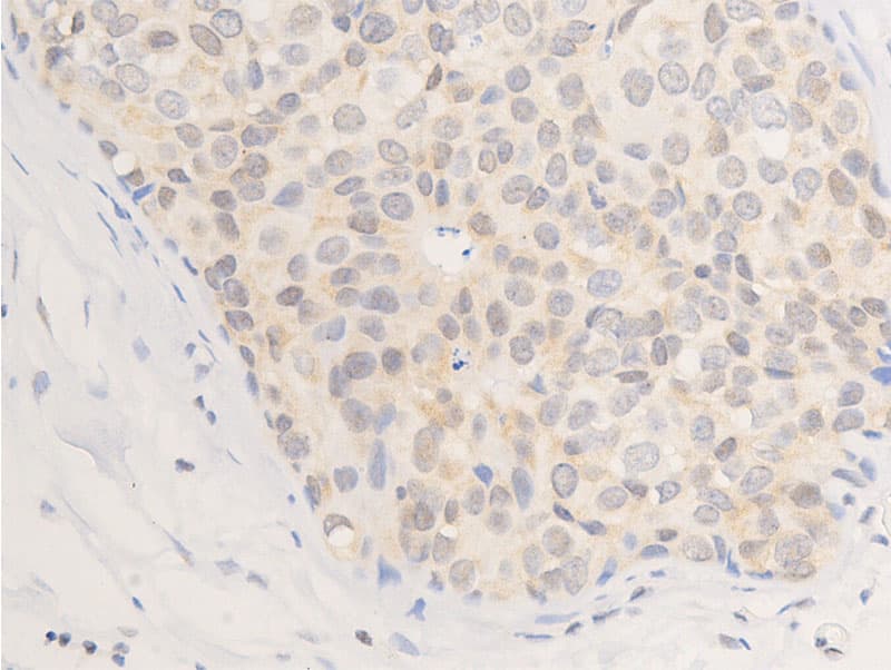 ERBB2 / HER2 Antibody (phospho-Tyr877)
