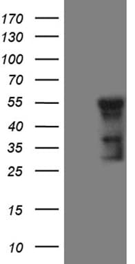 GCM1 Antibody (clone OTI1A5, Carrier-free)