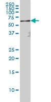 IHC-plus™ RELA / NFKB p65 Antibody (clone 8G3)