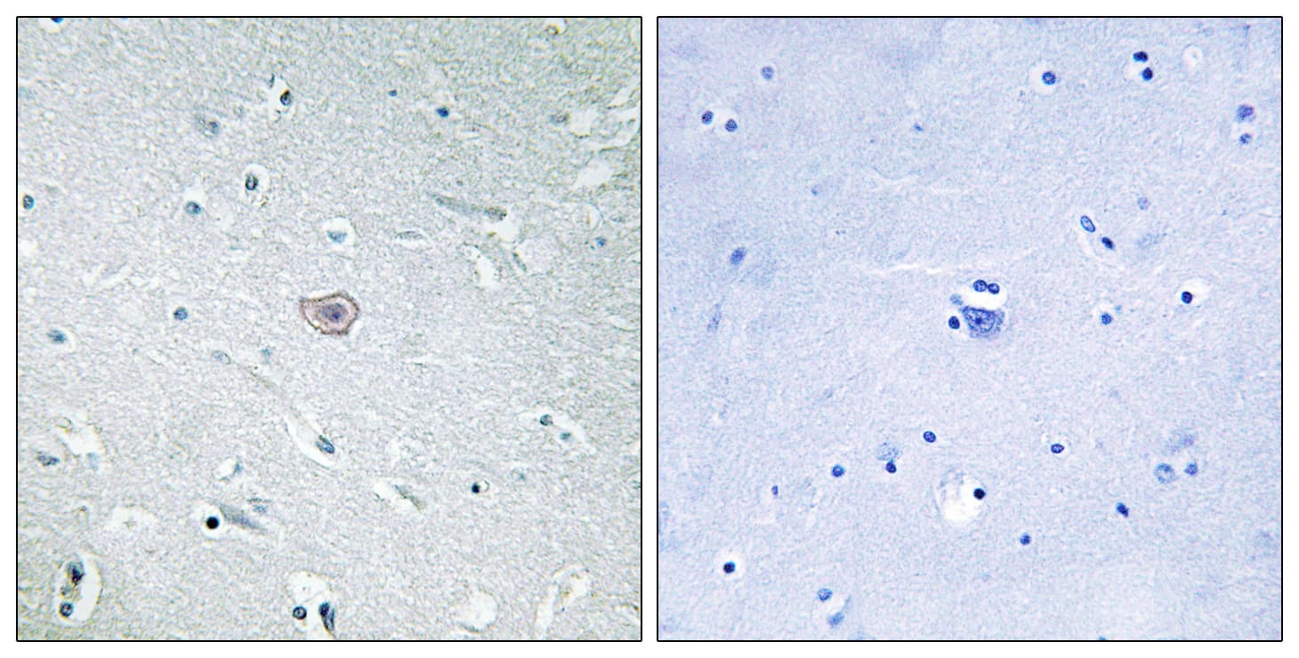 PTGER3 / EP3 Antibody (aa1-50)