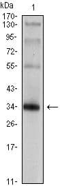 SYP / Synaptophysin Antibody (clone 7H12)