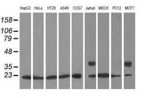 ARHGDIA / RHOGDI Antibody (clone OTI1F2, Carrier-free)
