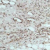 CALHM1 Antibody