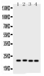 SOCS2 Antibody (aa96-198)