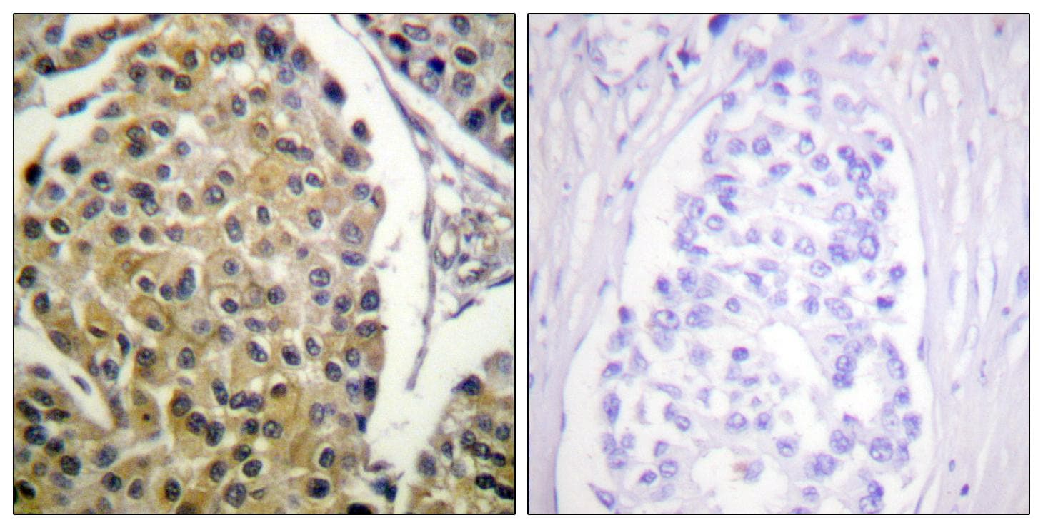 Polyclonal Rabbit anti-Human PRKCD / PKC-Delta Antibody (phospho-Tyr313, IHC, WB)