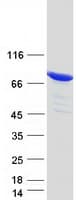 Human ESRP1 / RBM35A Protein (Recombinant Myc-DDK (Flag))