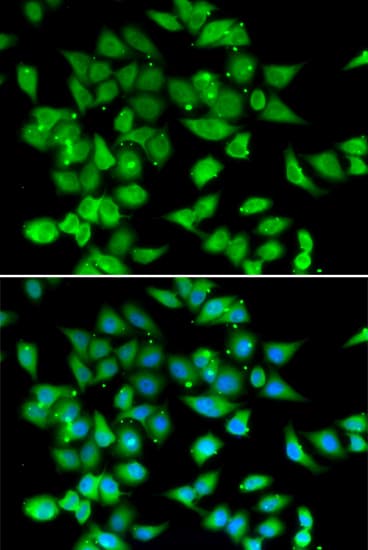 NFAT4 / NFATC3 Antibody