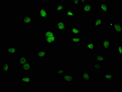 Polyclonal Rabbit anti-Human KRCC1 Antibody (WB)