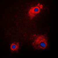 Polyclonal Rabbit anti-Human GSK3A / GSK3 Alpha Antibody (phospho-Ser21, IHC, IF, WB)