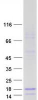 Human SPINT4 Protein (Recombinant Myc-DDK (Flag))