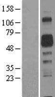 AMIGO2 Protein (Over-Expression Lysate Myc-DDK (Flag))