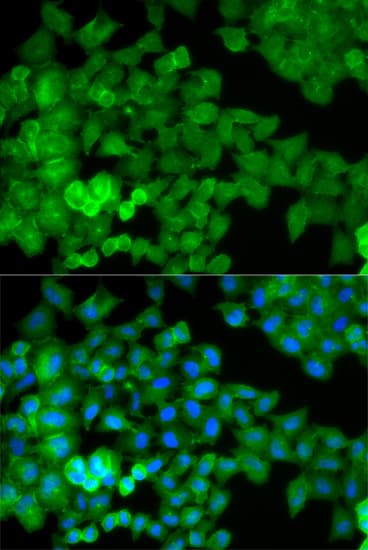 Polyclonal Rabbit anti-Human JUP/CTNNG/Junction Plakoglobin Antibody (IHC, IF, WB)