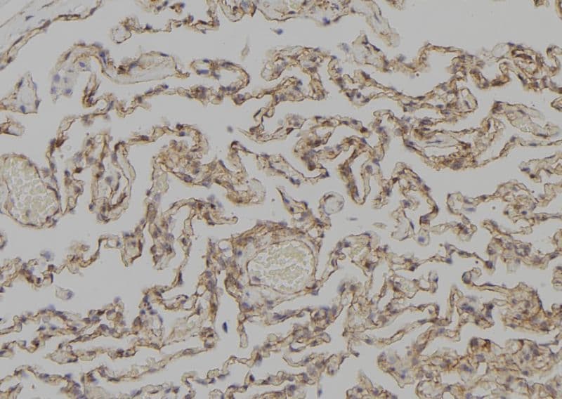 KRT4 / CK4 / Cytokeratin 4 Antibody