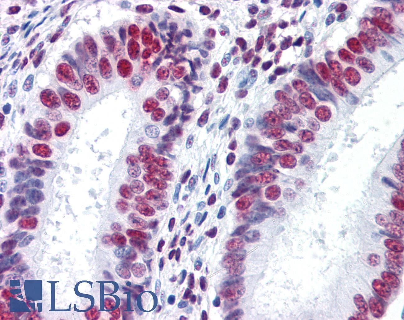 IHC-plus™ HNRPM / HNRNPM Antibody (clone 3F7)