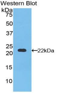 APOB / Apolipoprotein B Antibody