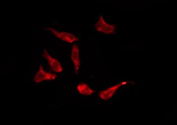 OR8S1 Antibody