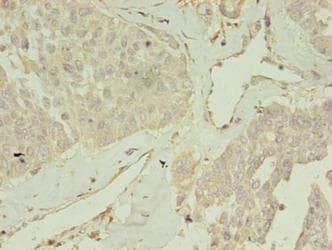 CCDC14 Antibody