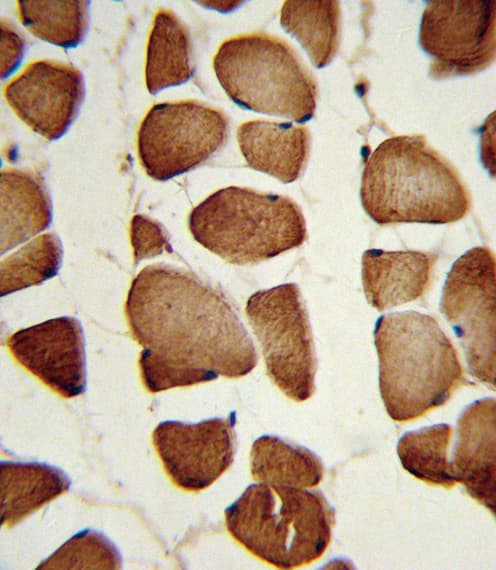 NAMPT / Visfatin Antibody (aa400-426)