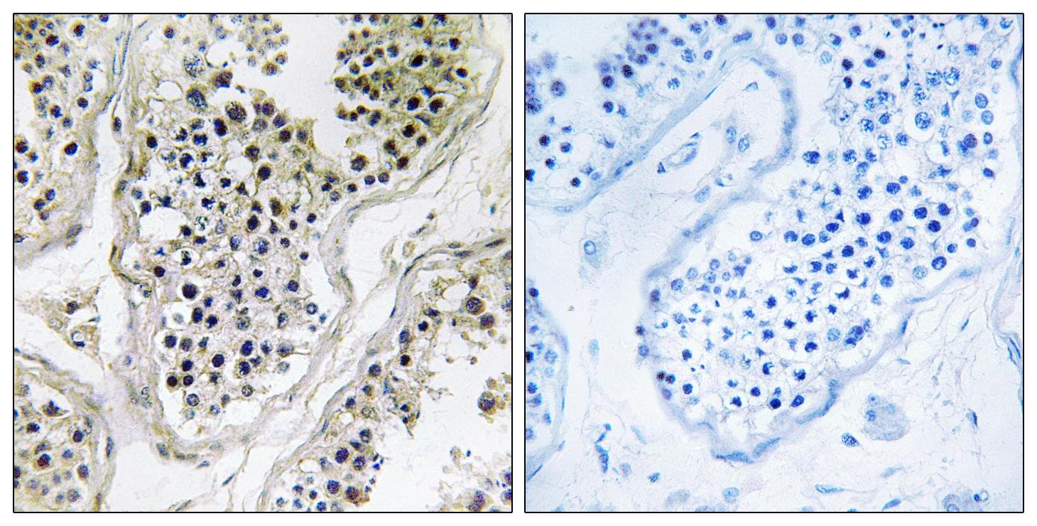 Polyclonal Rabbit anti-Human ATXN7L1 Antibody (IHC)