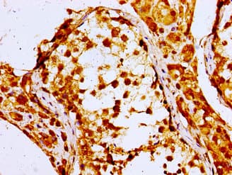 NPC / NPC1 Antibody