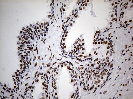 TP53BP1 / 53BP1 Antibody (aa1-300, clone OTI2G3)