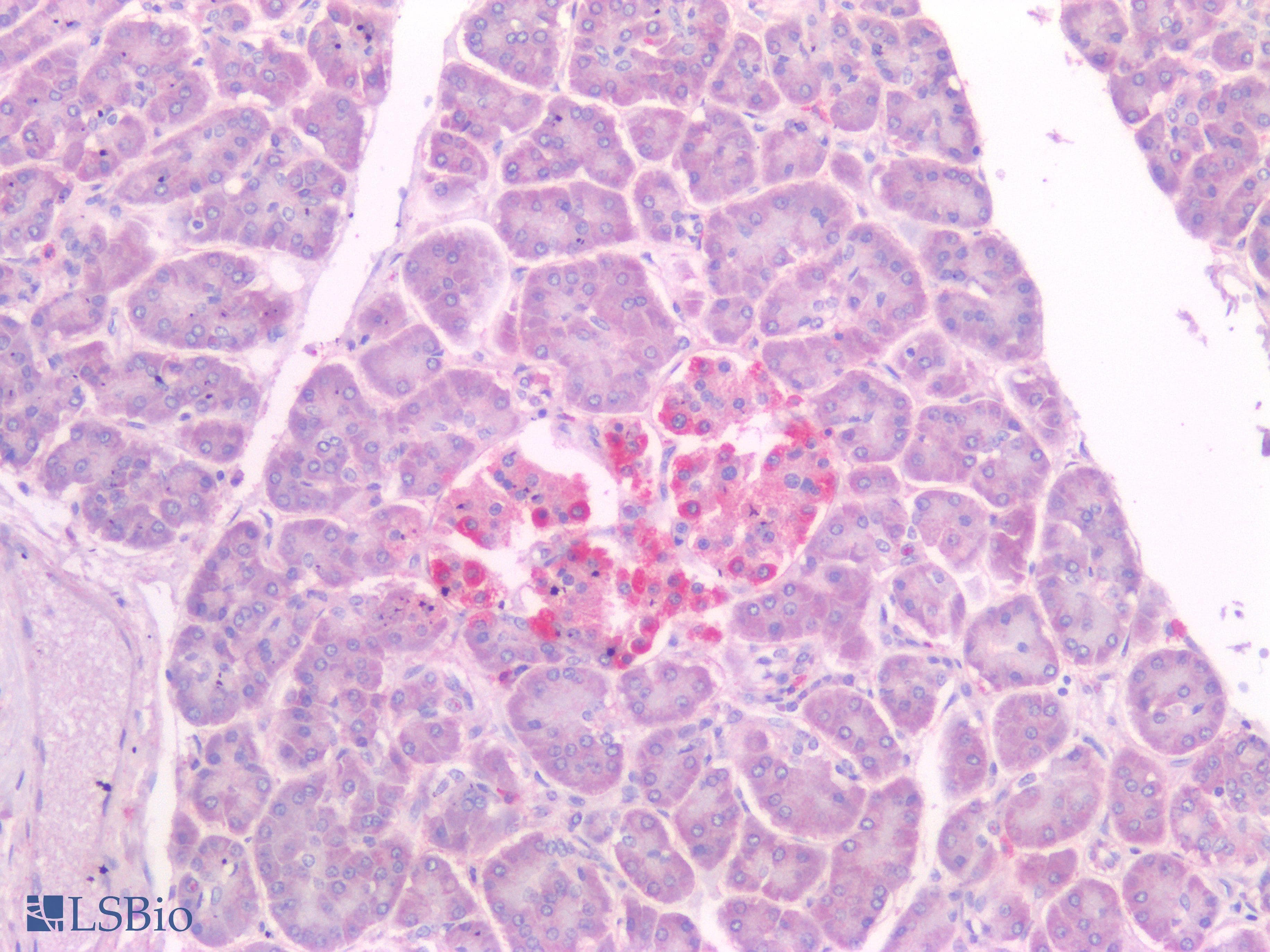 IHC-plus™ NKX6-1 Antibody