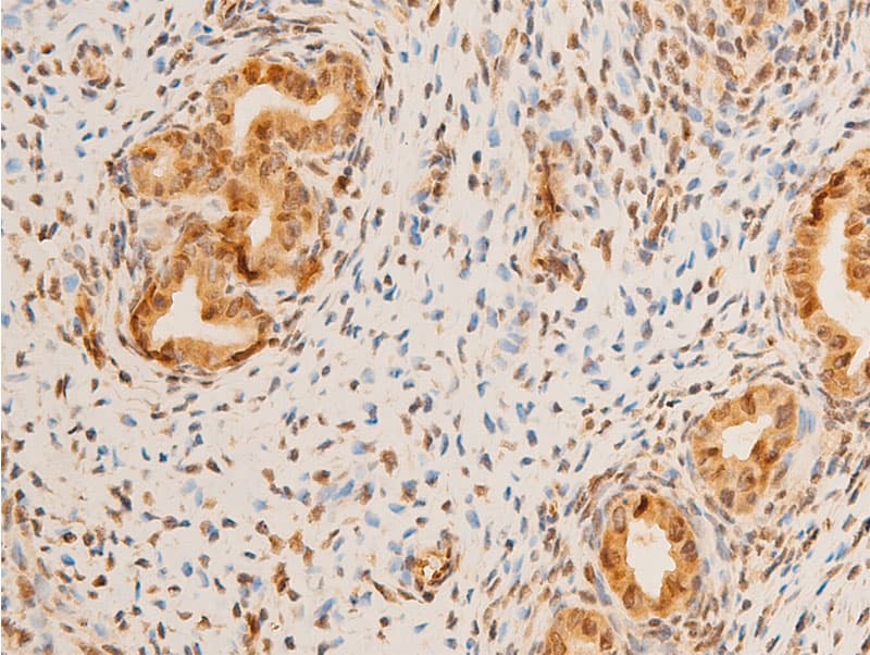LMNA / Lamin A+C Antibody (phospho-Ser392)