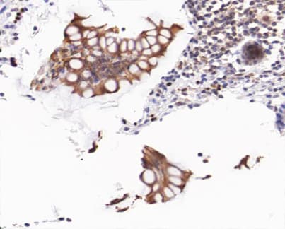 CTNNB1 / Beta Catenin Antibody (phospho-Ser37)