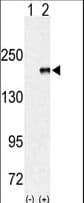 EHMT1 Antibody (aa979-1010)