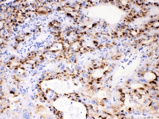 CYP3A4 / Cytochrome P450 3A4 Antibody