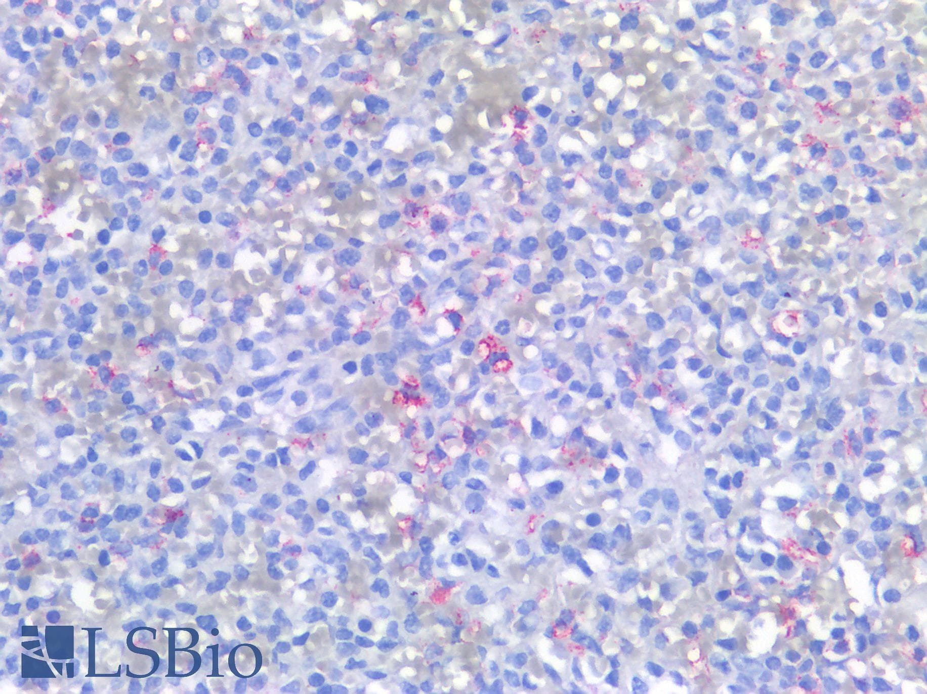 PathPlus™ Monoclonal Mouse anti-Human Hairy Cell Leukemia Antibody (clone DBA.44, IHC)