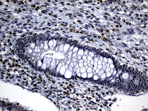 ELL / MEN Antibody (aa302-621, clone OTI5E12)