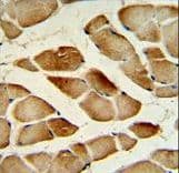Polyclonal Rabbit anti-Human CTSF / Cathepsin F Antibody (aa261-290, IHC, WB)