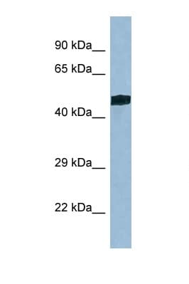 TRIT1 Antibody (aa20-69)