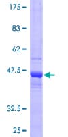 Human COMMD3 / BUP Protein (Recombinant GST)