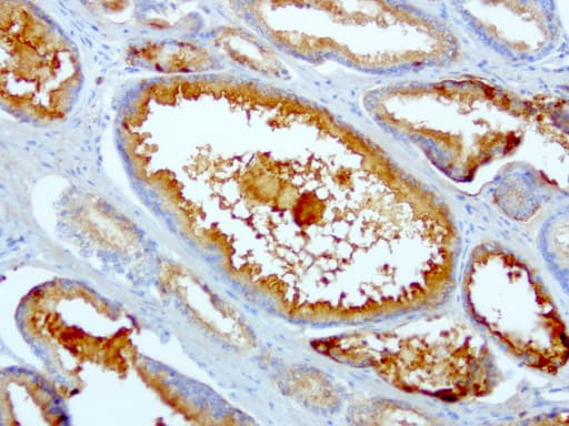 SDCBP / Syntenin Antibody (clone UMAB69)