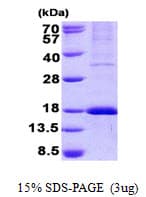 Human WLS / GPR177 Protein (Recombinant His)