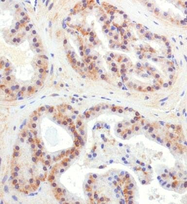 CHORDC1 / CHP1 Antibody