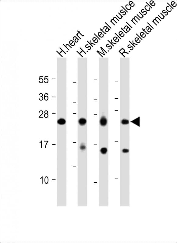 MLC3F / MYL1 Antibody (Internal)