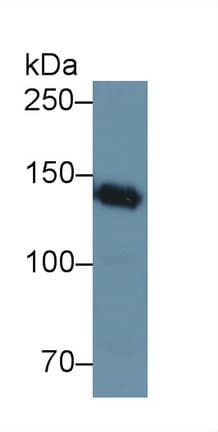 Polyclonal Rabbit anti-Human NPHS1 / Nephrin Antibody (aa27-234, WB)