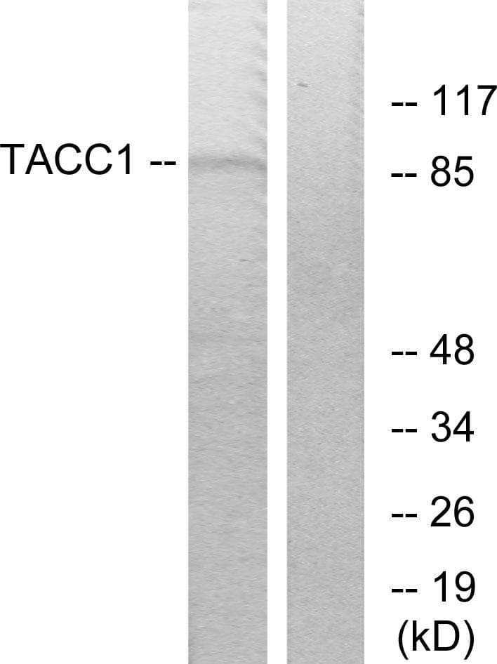 Polyclonal Rabbit anti-Human TACC1 Antibody (IF, WB)