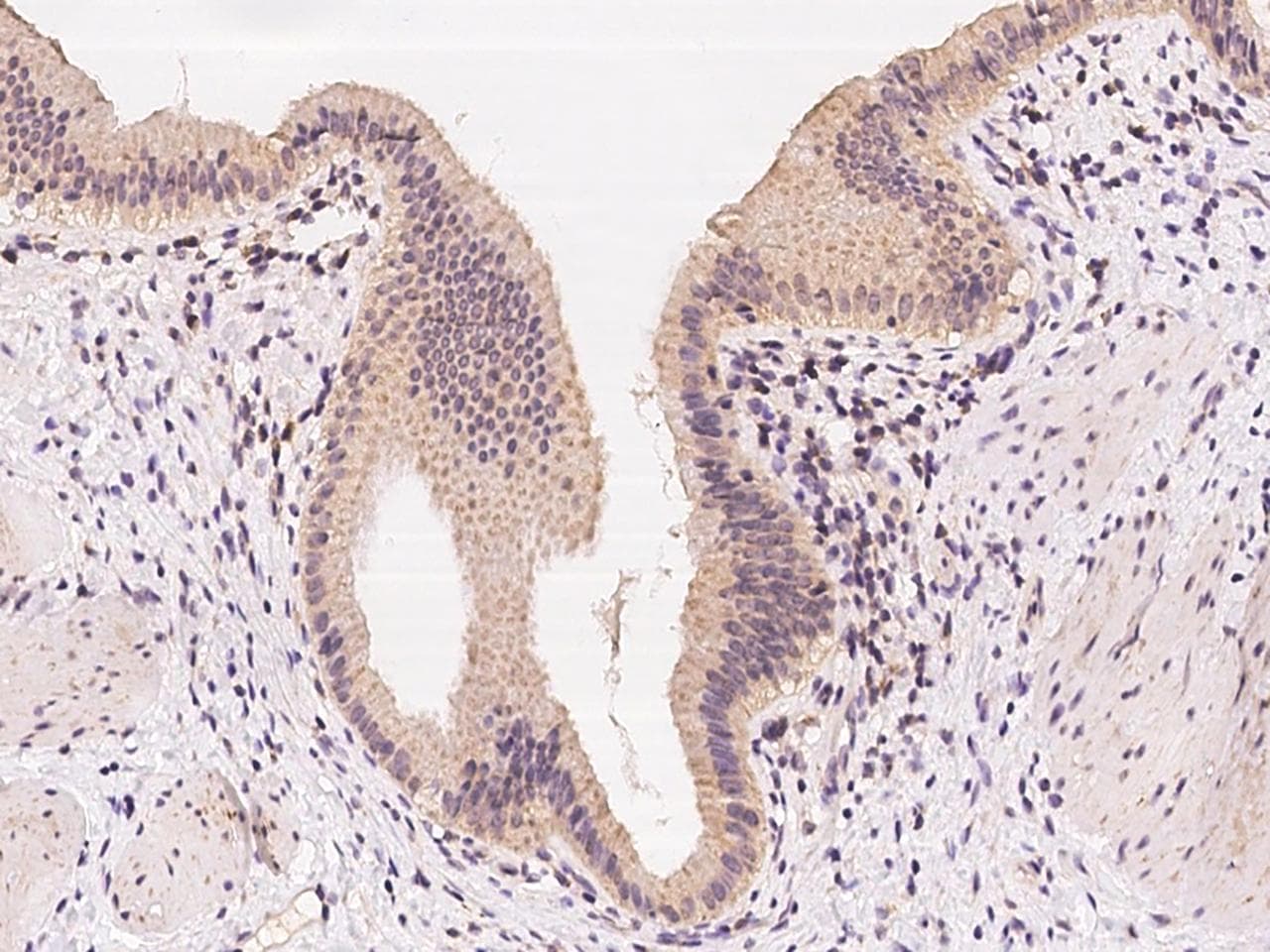 ZNF879 Antibody