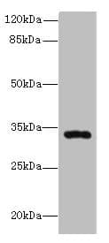 HSD17B11 Antibody (aa20-300)